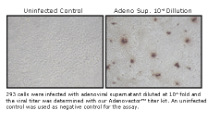 Adenovector™ Rapid Titer Kit (60 titrations) Adenovector™ Rapid Titer Kit (60 titrations)