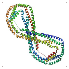 Human apolipoprotein A1 , Apo-A1 ELISA Kit
