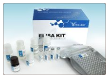 Mouse anti-cardiolipin antibody , IgG ELISA Kit